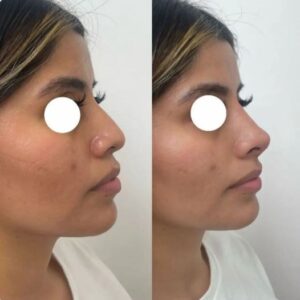 Inicio V 300x300